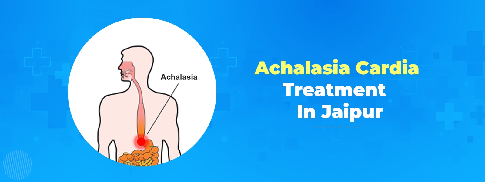 Achalasia Cardia Treatment in Jaipur