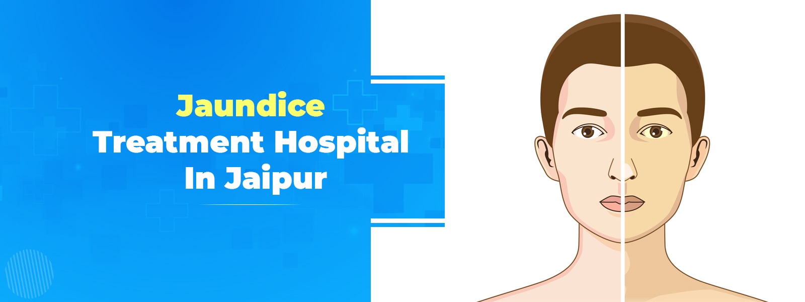 Jaundice Treatment Hospital in Jaipur